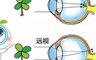 眼睛视力怎么看，眼睛视力怎么看懂检查报告