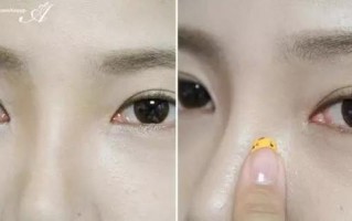 眼镜鼻托变黄怎么洗干净，眼镜鼻托变黄怎么洗干净呢