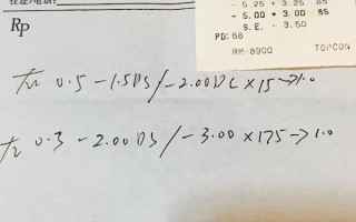 散光轴位度数怎么看，散光轴位是散光度数吗